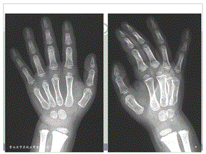 最新：骨与关节系统正常影像表现2003ppt课件文档资料.ppt