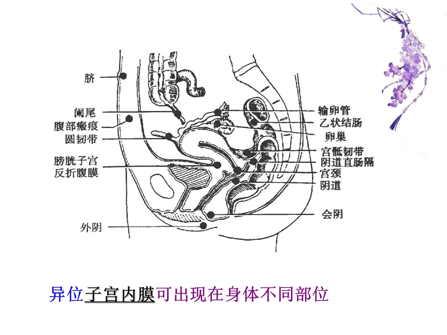 最新：子宫内膜异位性疾病课件文档资料.ppt_第1页