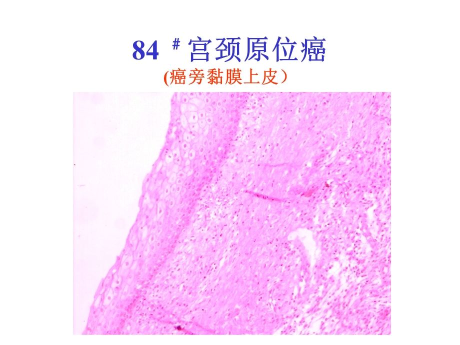 病理课件生殖系统疾病精选文档.ppt_第2页