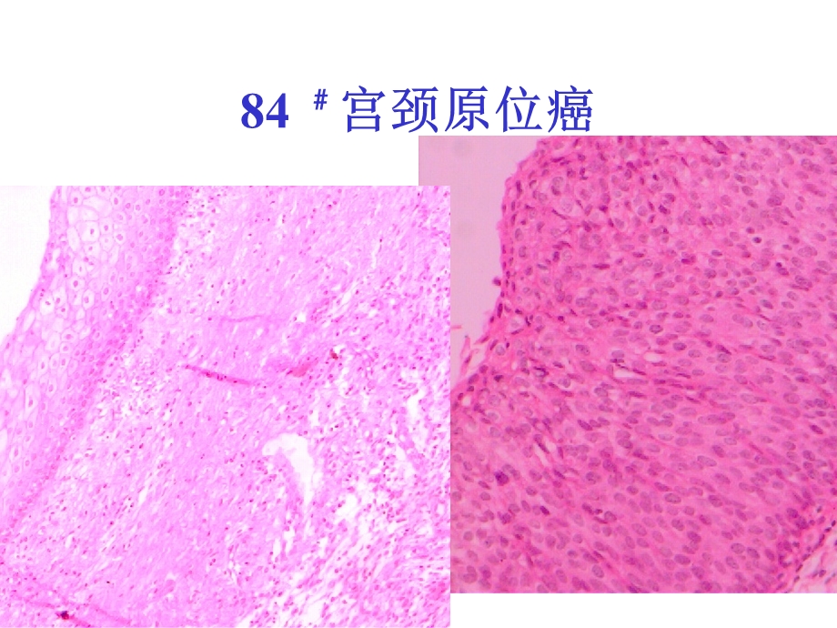 病理课件生殖系统疾病精选文档.ppt_第3页