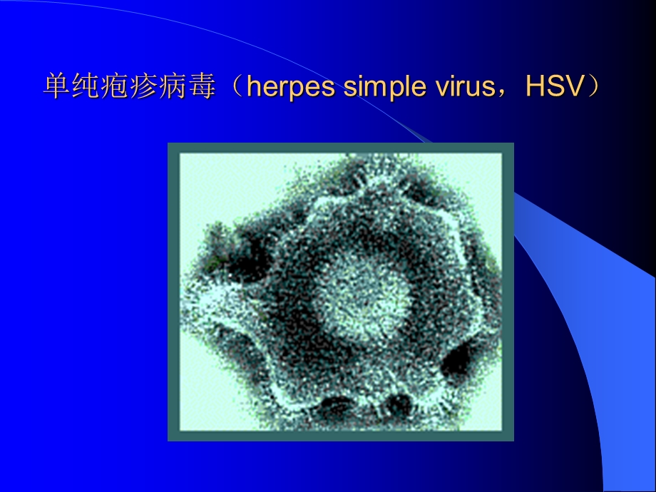 疱疹病毒介绍文档资料.ppt_第2页