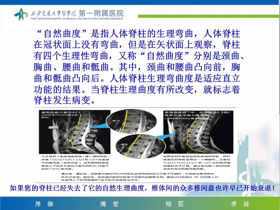 像爱护牙齿一样爱护我们的脊柱文档资料.ppt_第2页