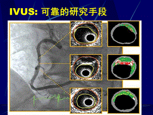 最新血脂探索与思考PPT文档.ppt