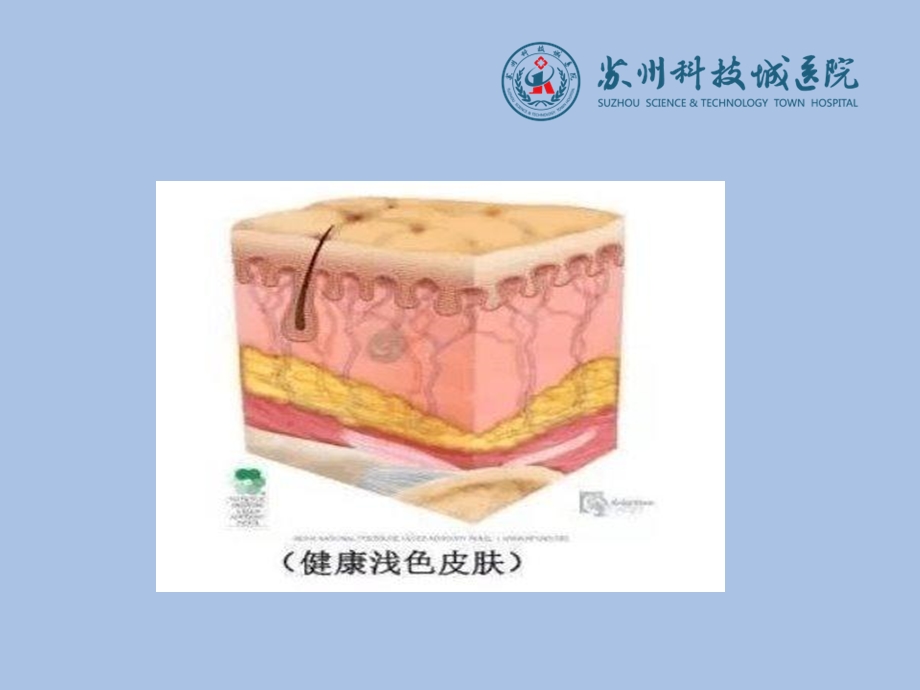 伤口敷料的选择及应用文档资料.ppt_第1页