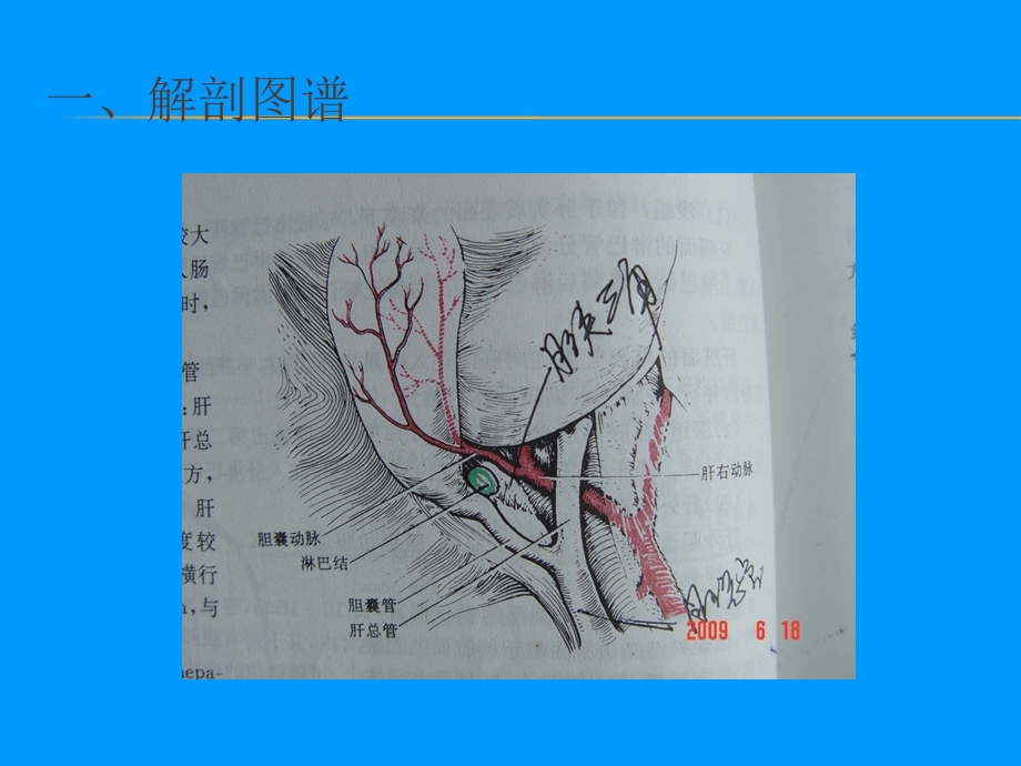 最新手术室护理——腹腔镜下胆囊切除、胆道镜下胆总管切开取石、胆总管一期缝合术PPT文档.ppt_第1页