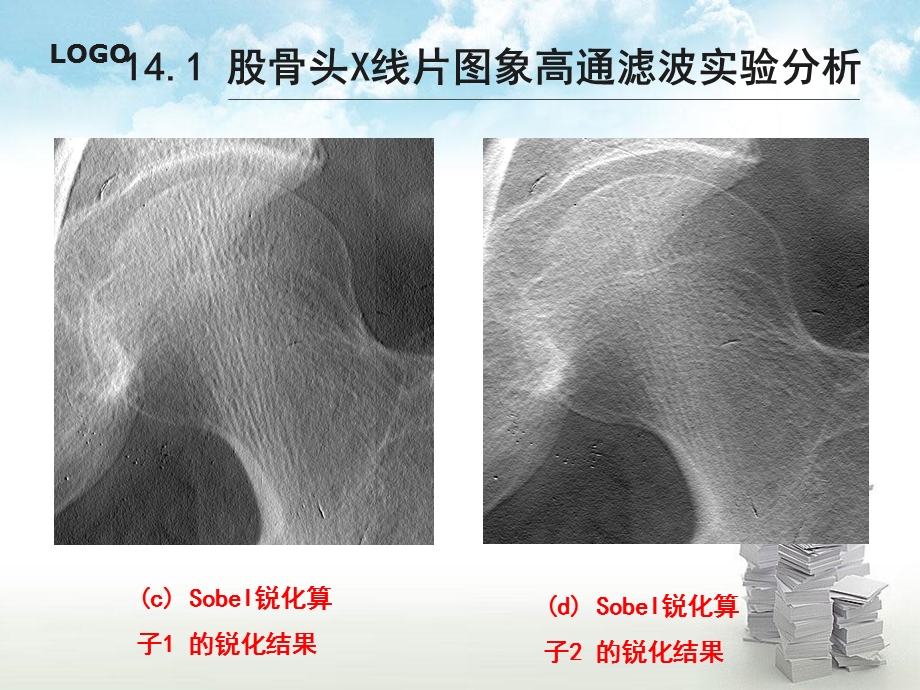 第14章基于空域运算的快速股骨头X线片图象增强方法文档资料.ppt_第2页