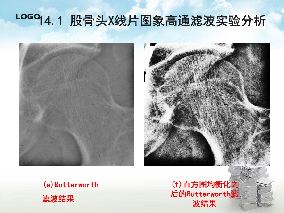 第14章基于空域运算的快速股骨头X线片图象增强方法文档资料.ppt_第3页