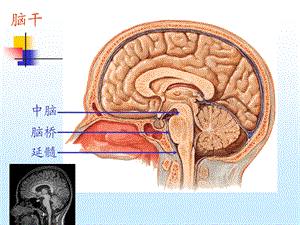 最新脑干与小脑解剖结构功能PPT文档.ppt