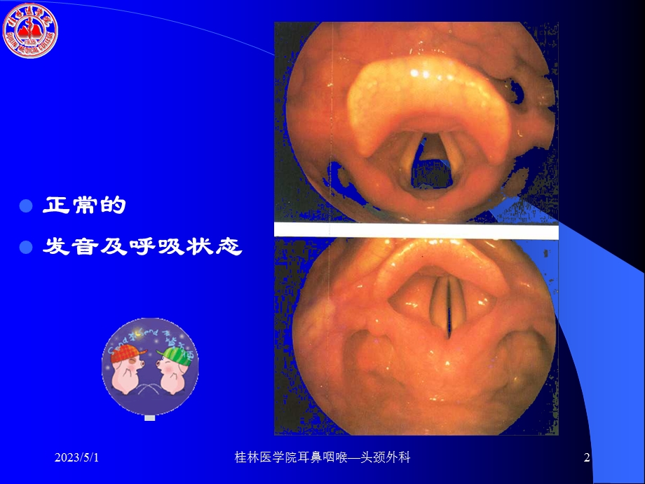 喉阻塞与急救精选文档.ppt_第2页