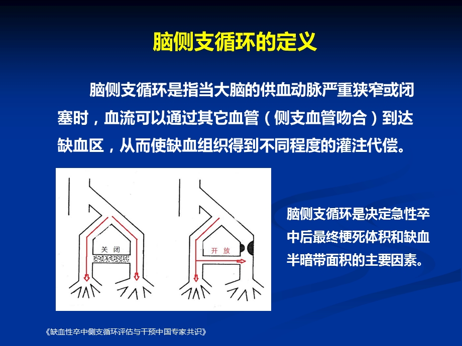 最新缺血性脑卒中的新视点侧支环课件PPT文档.ppt_第2页