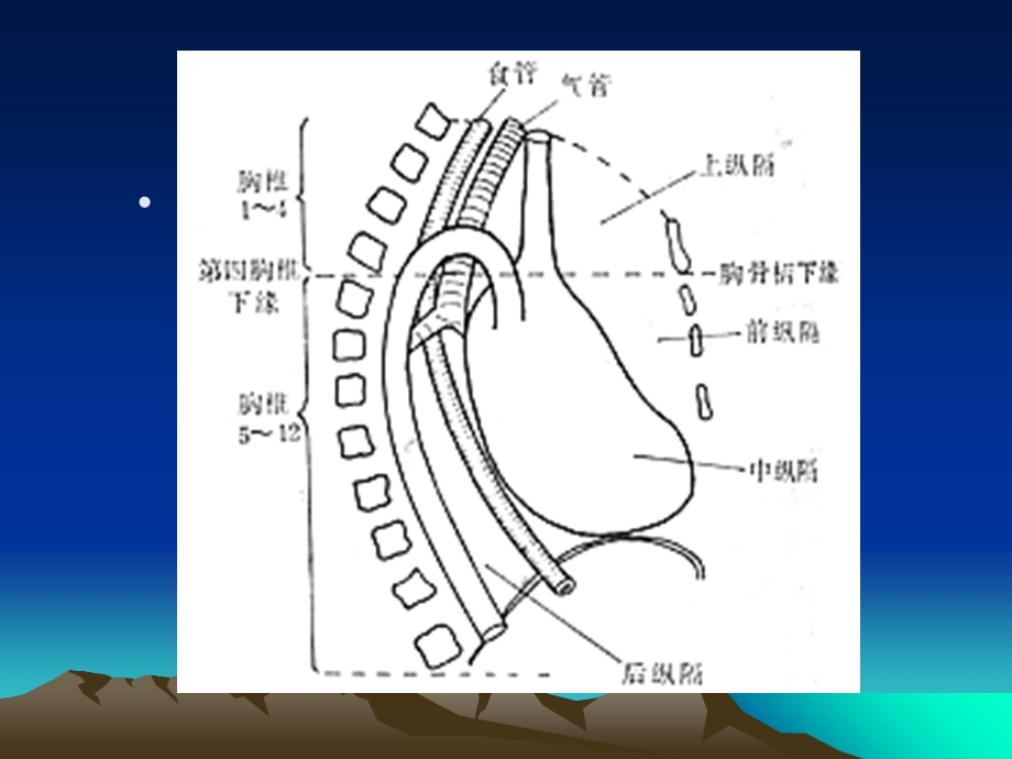 纵隔肿瘤影像诊断文档资料.ppt_第2页