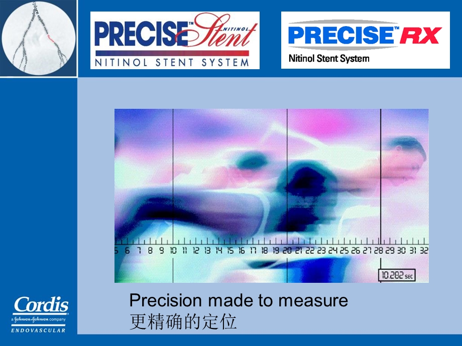 Cordis颈动脉狭窄介入治疗整体解决方案PPT文档.ppt_第1页