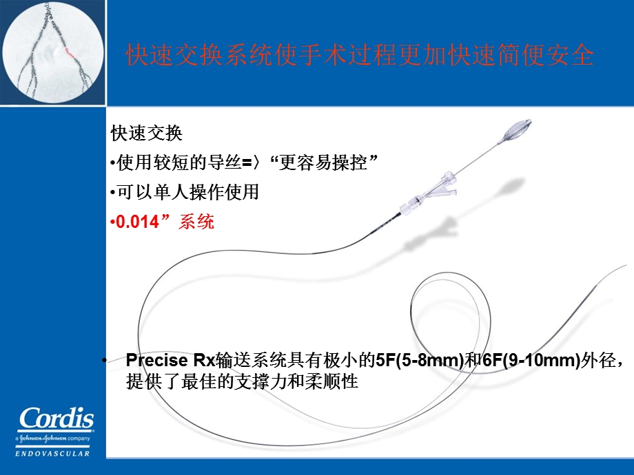 Cordis颈动脉狭窄介入治疗整体解决方案PPT文档.ppt_第3页