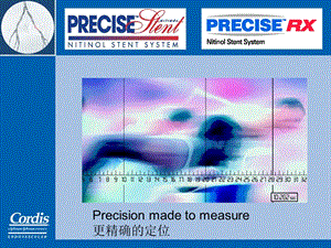 Cordis颈动脉狭窄介入治疗整体解决方案PPT文档.ppt