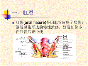 最新腹部疾病直肠肛管疾病外科学课件PPT文档.ppt