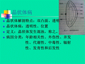 最新：晶状体病课菏泽医专眼科学教研室文档资料.ppt