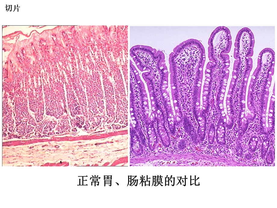 [临床医学]泸州医学院病理考试切片.ppt_第2页