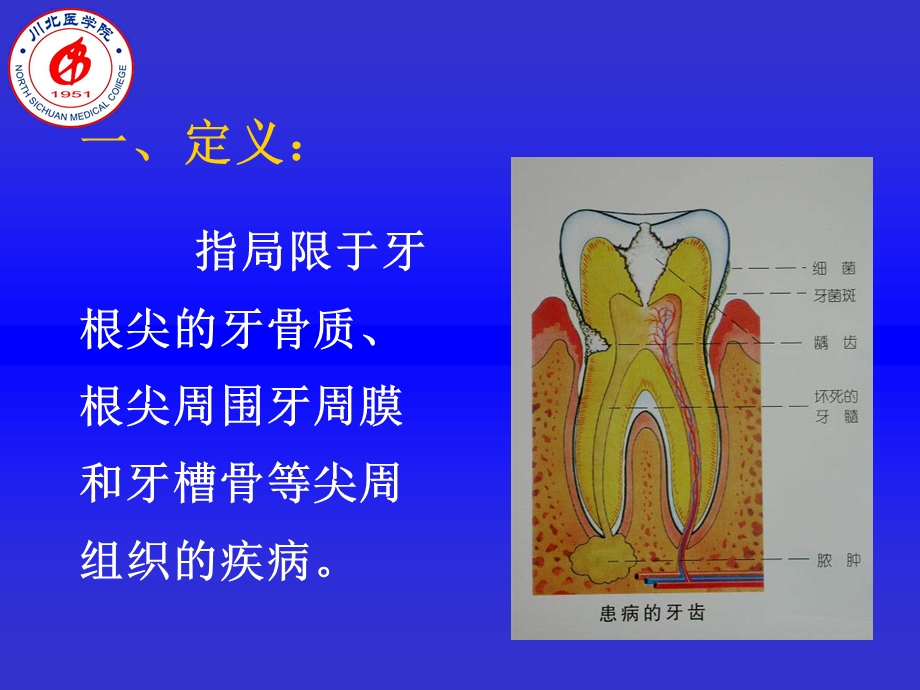 口腔牙体牙髓病学第十三章根尖周病的临床表现及诊断PPT文档.ppt_第2页