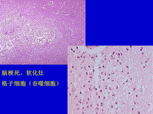 最新：病理学实习镜下神经系统文档资料.ppt