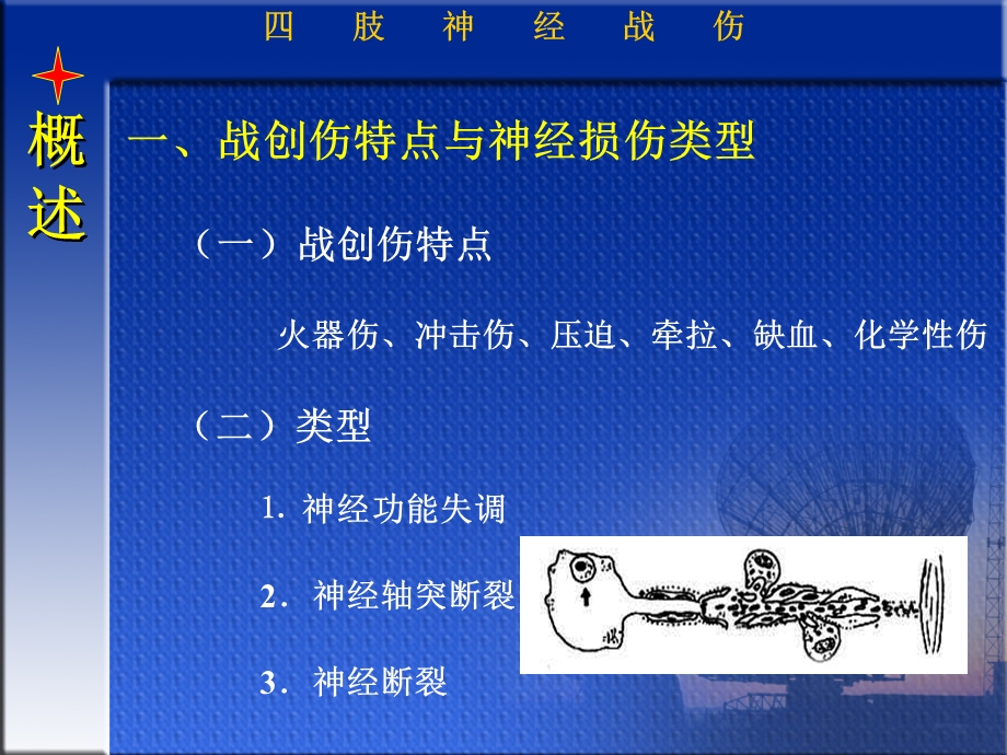 四肢神经战伤文档资料.ppt_第2页