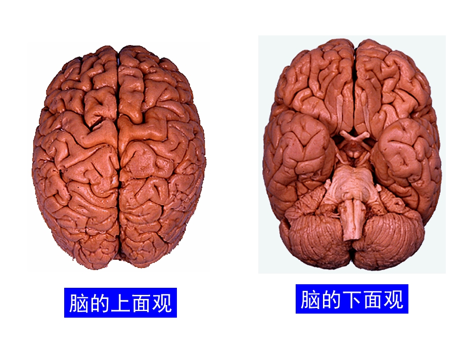 新乡医学院人体解剖学脑干ppt课件精选文档.ppt_第3页