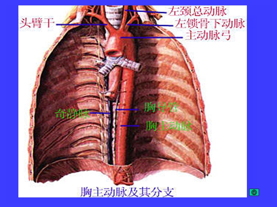 最新：体循环动脉ppt文档资料.ppt_第3页