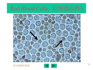 最新：实验诊断学尿沉渣镜检图谱3文档资料.ppt