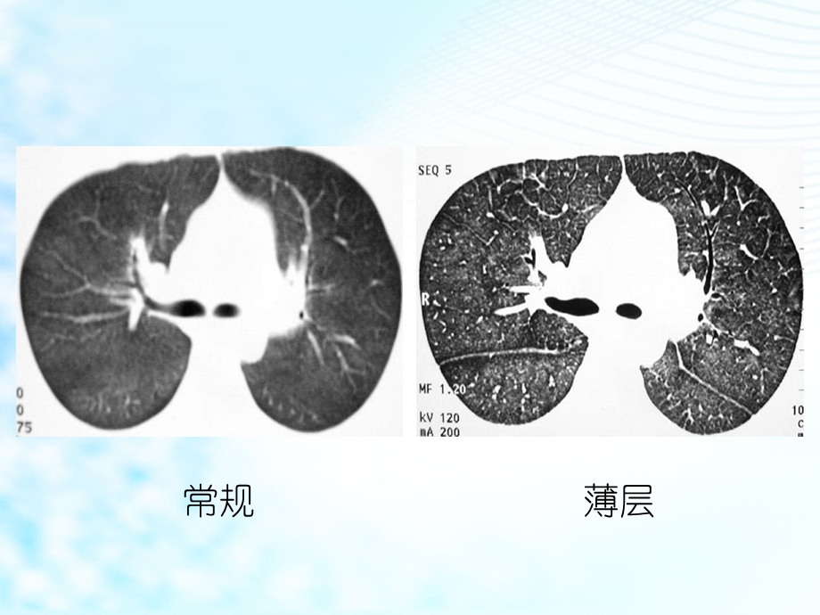 最新：胸部CT教学用PPT课件文档资料.ppt_第2页