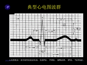 最新：心电图入门的精要文档资料.ppt