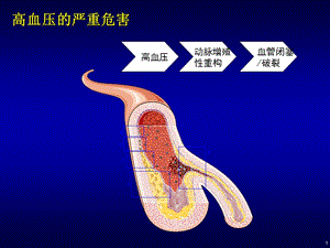 最新苯磺左旋氨氯地平在高血压临床治疗中的有效性及安全性评价PPT文档.ppt