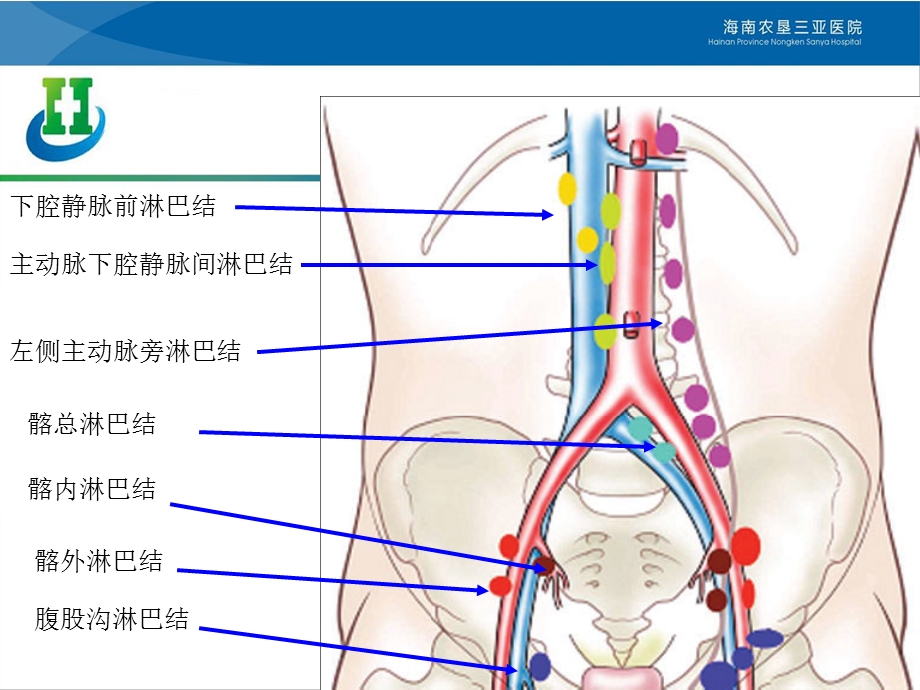 最新盆腔淋巴结的影像解剖及临床应用PPT文档.ppt_第3页