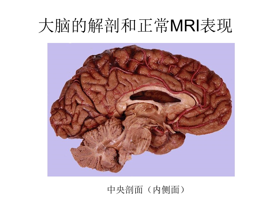 大脑的解剖和正常mri表现精选文档.ppt_第2页