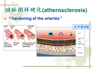 心血管系统疾病ppt课件PPT文档.ppt