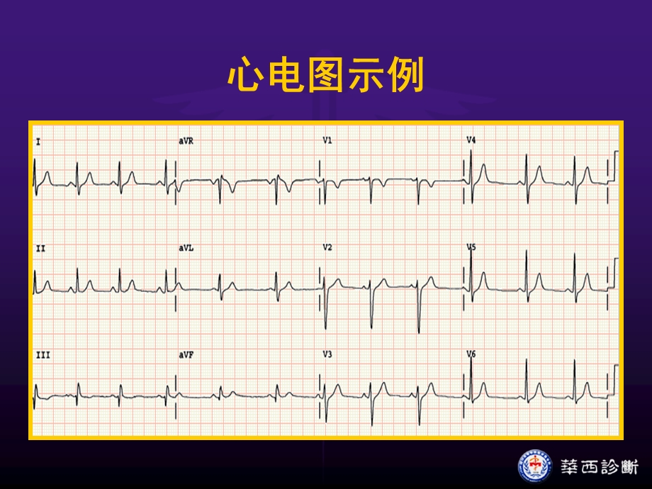 最新：心电图学分析课件文档资料.ppt_第2页