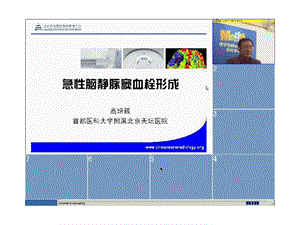 [临床医学]颅内静脉和静脉窦血栓形成的影像学表现.ppt