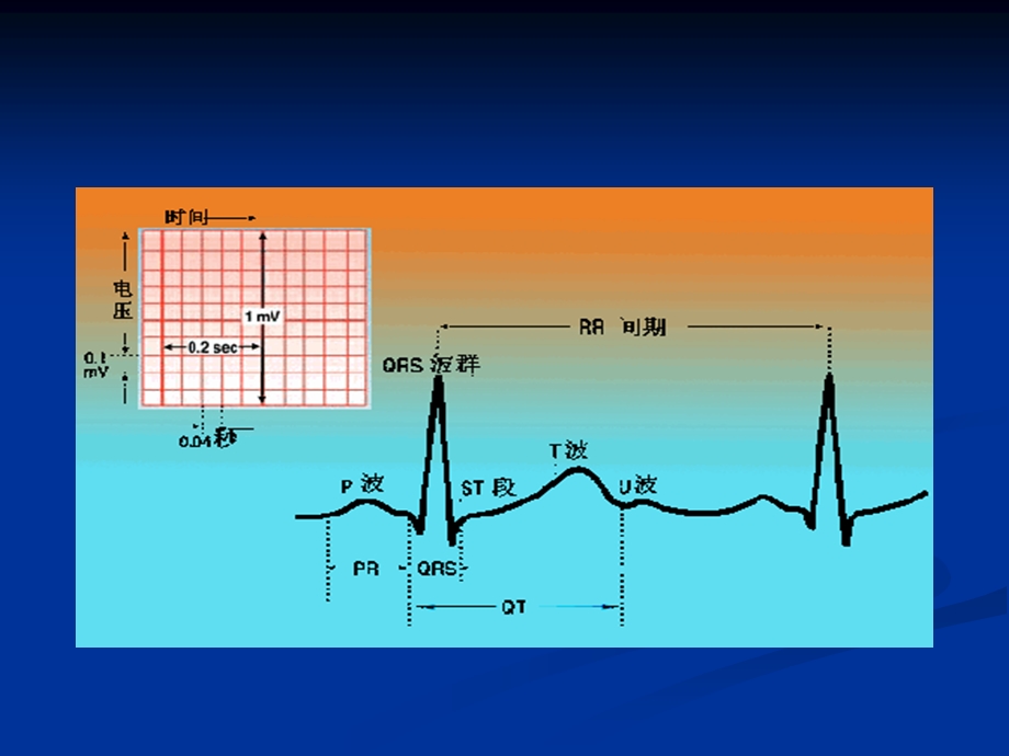 最新：如何看心电图2文档资料.ppt_第3页