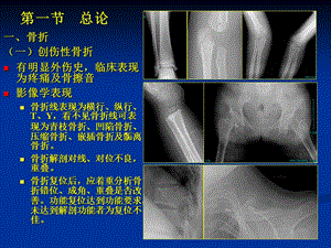 最新：骨与关节创伤PPT课件文档资料.ppt