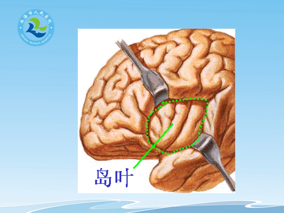 大脑半球各叶的功能文档资料.pptx_第3页