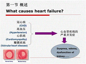 最新第十四章心力衰竭heartfailure精品PPT课件PPT文档.ppt