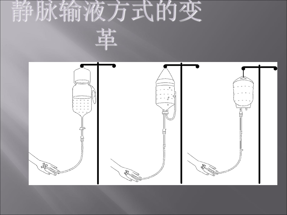 最新静脉输液安全PPT文档.ppt_第2页