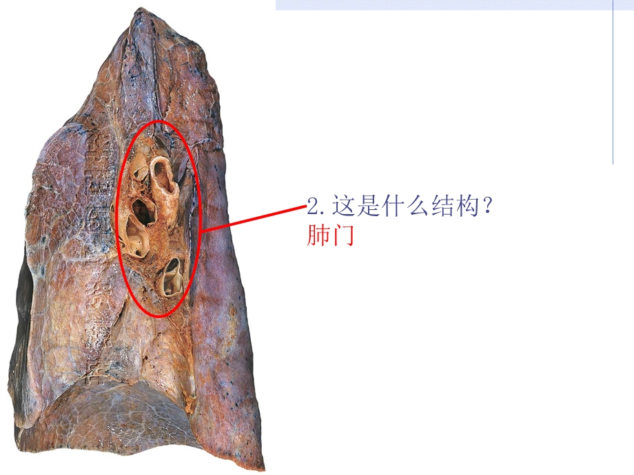 最新：系统解剖学iii级标本考试文档资料.ppt_第2页