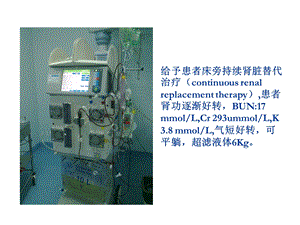 最新：血液净化 ppt课件文档资料.ppt