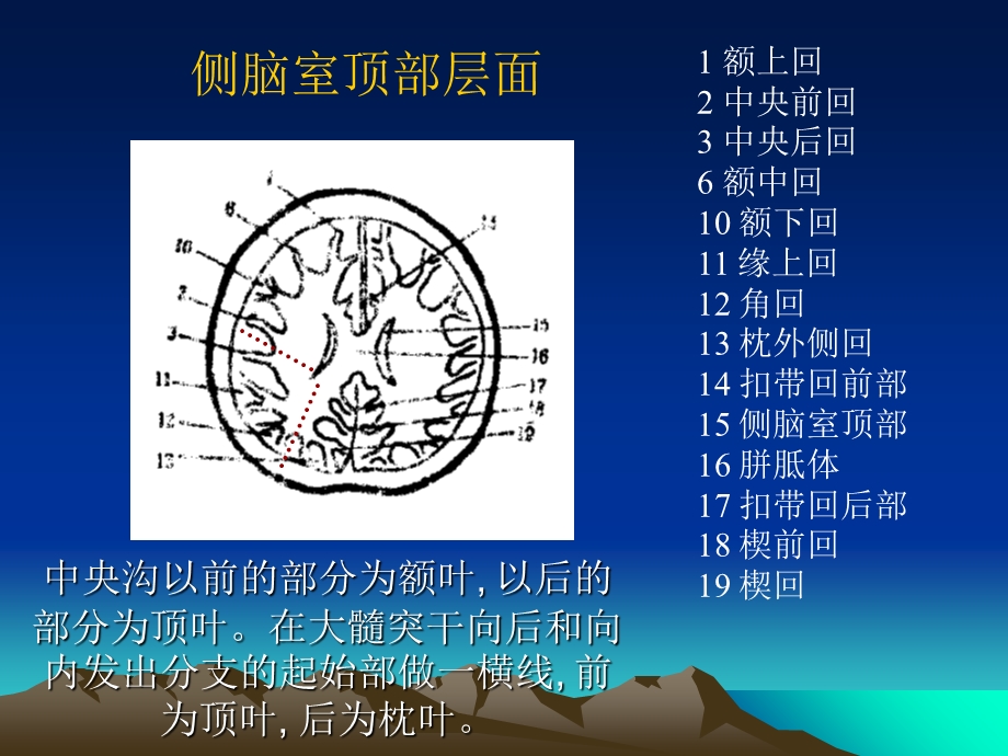 大脑脑回脑叶CT及MR定位文档资料.ppt_第2页