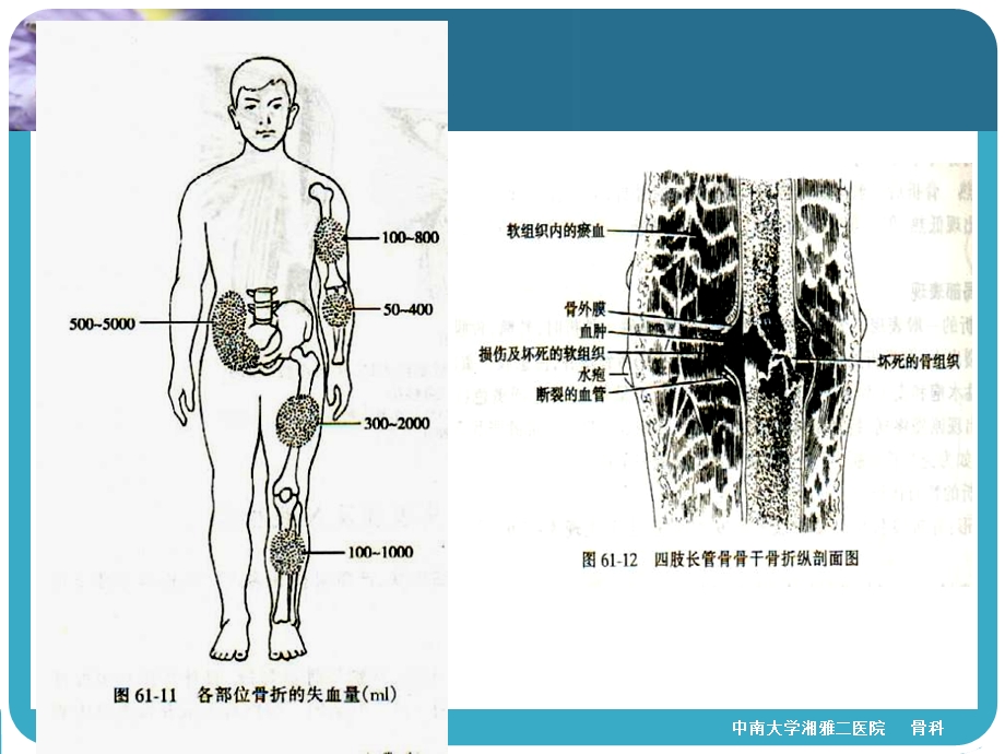 最新：四肢骨折经典文档资料.ppt_第2页