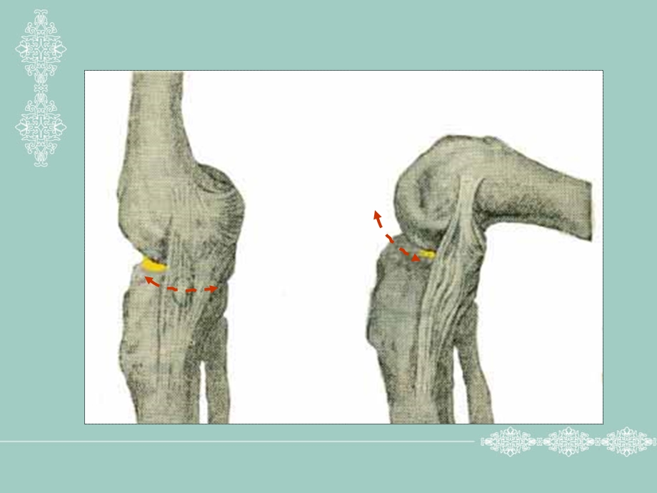 最新：膝关半月板损伤课件文档资料.ppt_第2页