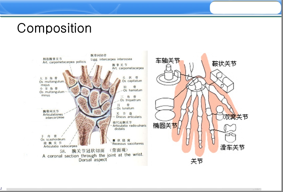 最新陈旧性bennett骨折的处理PPT文档.ppt_第2页