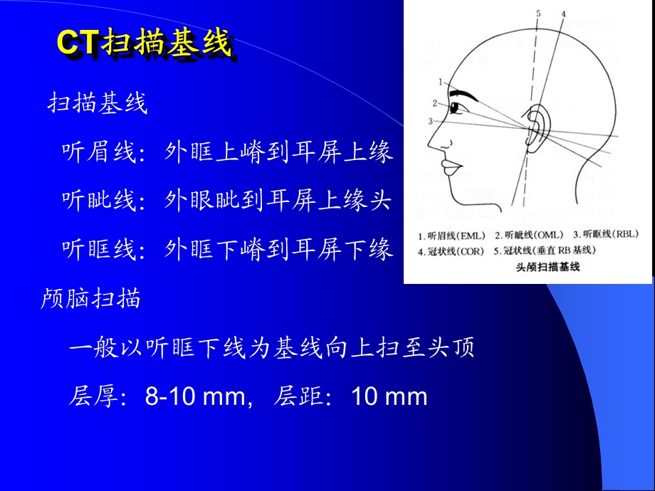 爱爱医资源头颅CT课件精选文档.ppt_第2页