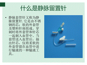 浅谈静脉留置针动画文档资料.ppt