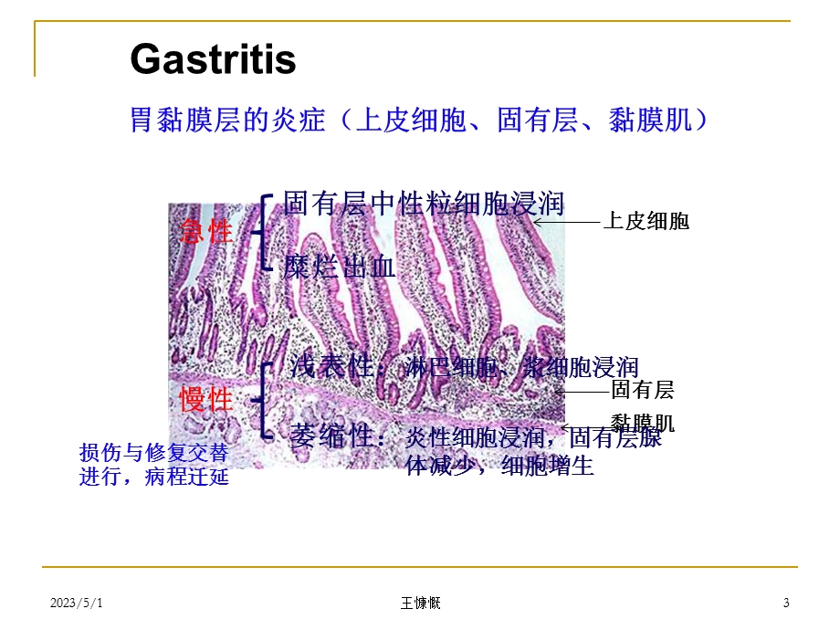 最新：消化系统疾病动物模型文档资料.ppt_第3页