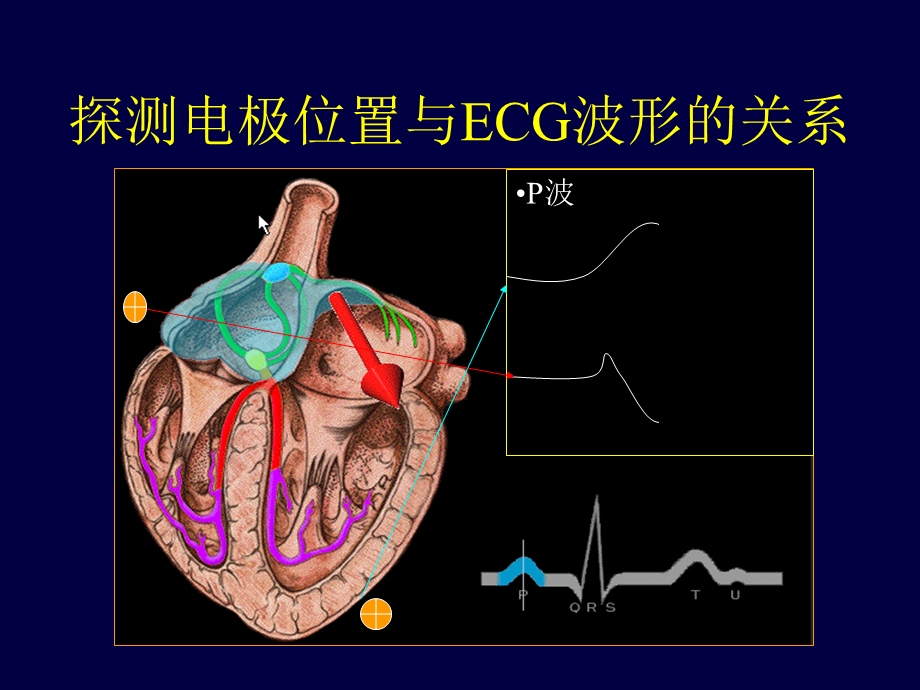 心电图学 课件PPT文档.ppt_第3页